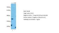 FoxF1 Antibody, Novus Biologicals 100 &mu;L; Unconjugated:Antibodies, Polyclonal